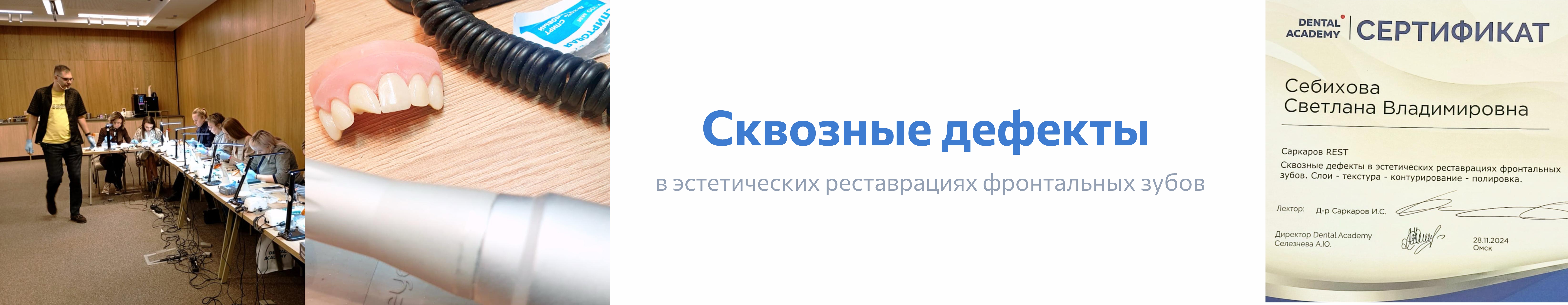  Изображение Сквозные дефекты в эстетических реставрациях